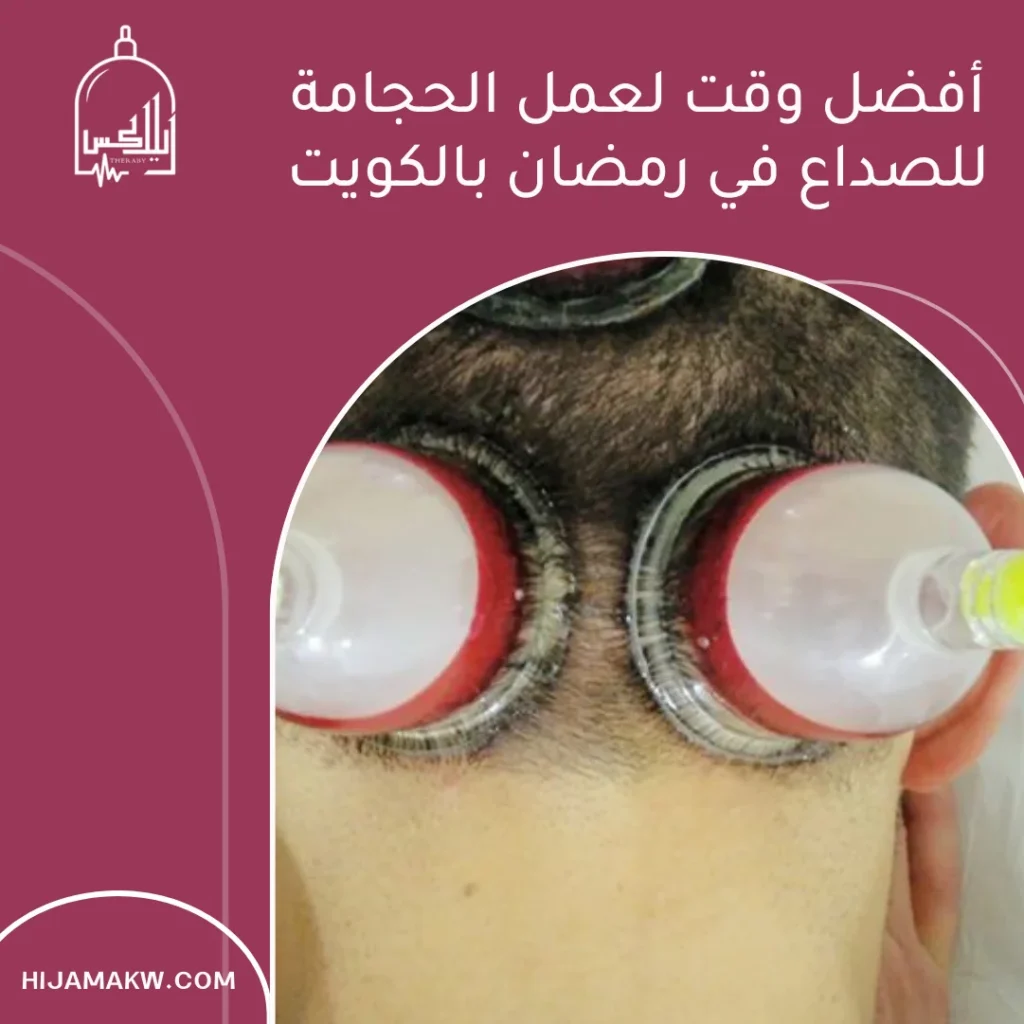 الحجامة للصداع في رمضان بالكويت الحل الفعال الحجامة للصداع في رمضان بالكويت