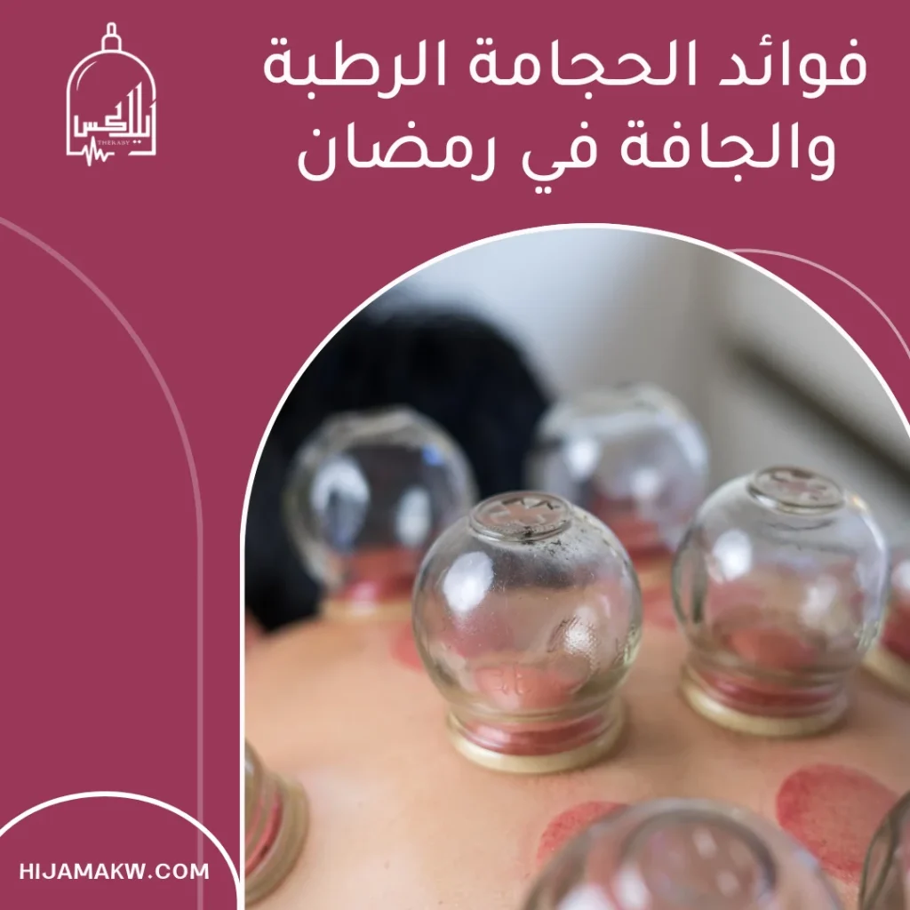 الحجامة الرطبة والجافة في رمضان بالكويت: الفرق وأفضل اختيار الحجامة الرطبة والجافة في رمضان