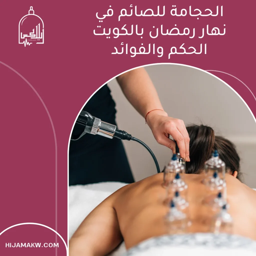 الحجامة للصائم في نهار رمضان بالكويت الحكم والفوائد الحجامة للصائم في نهار رمضان