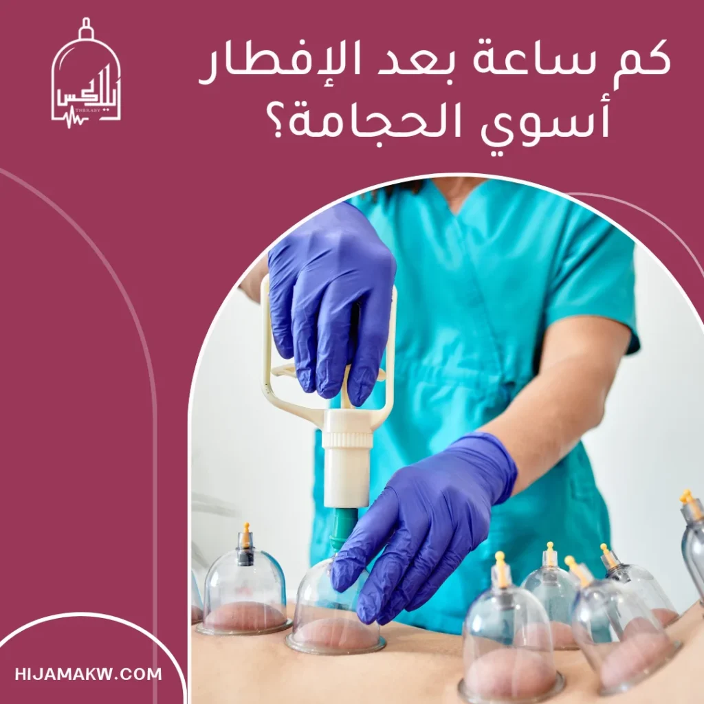 كم ساعة بعد الإفطار أسوي الحجامة في رمضان بالكويت؟ كم ساعة بعد الإفطار أسوي الحجامة