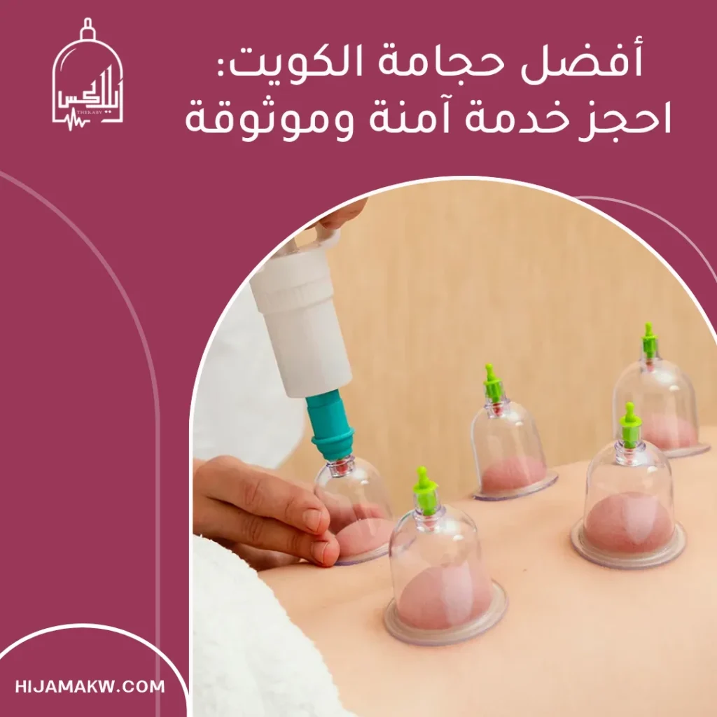 حجامة الكويت