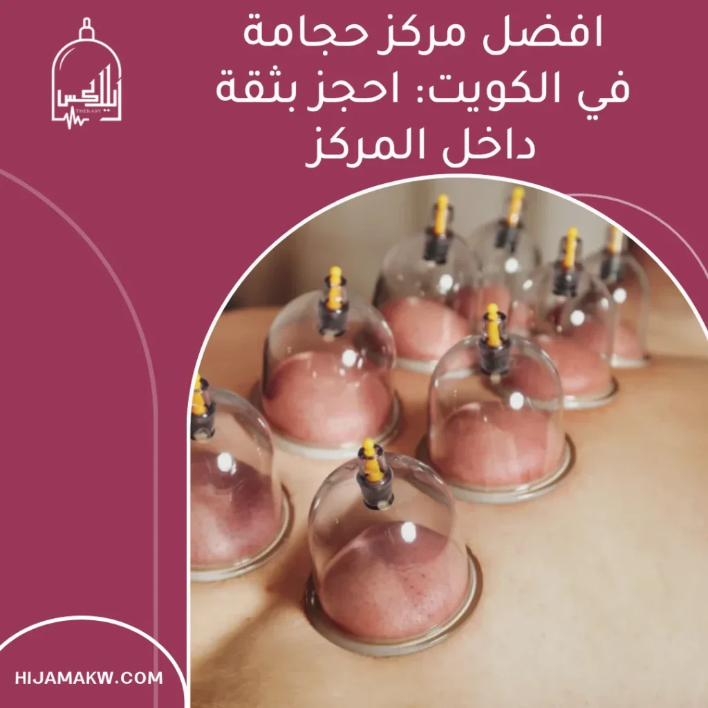 افضل مركز حجامة في الكويت