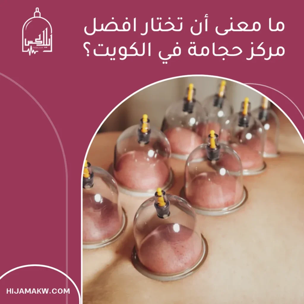 افضل مركز حجامة في الكويت