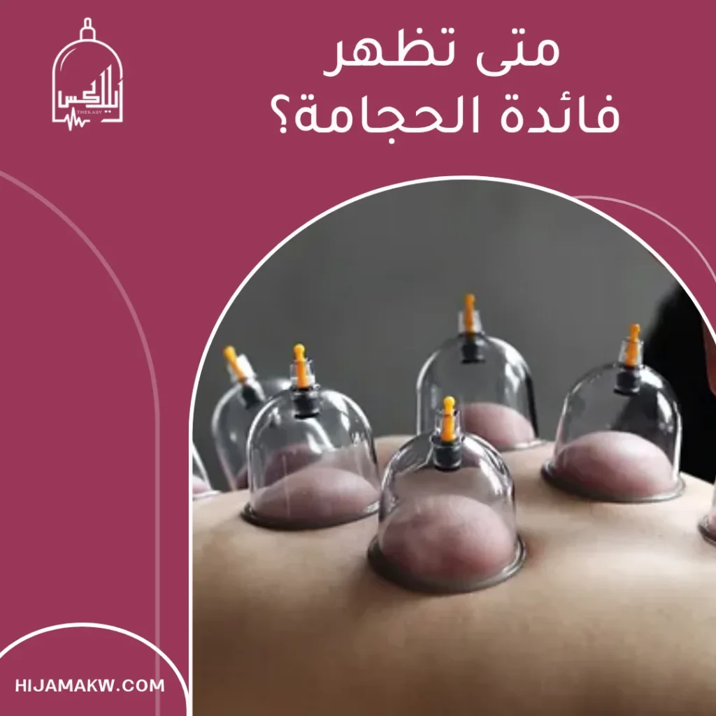 عروض حجامة في الكويت 