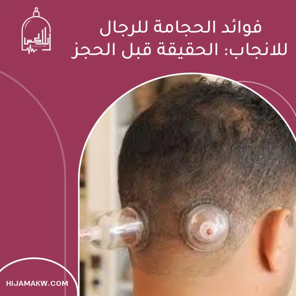 فوائد الحجامة للرجال للانجاب