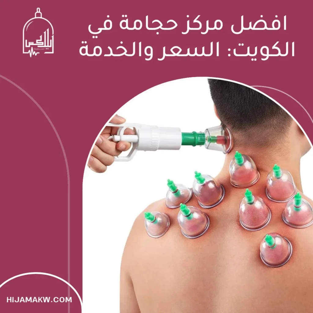 افضل مركز حجامة في الكويت: السعر والخدمة افضل مركز حجامة في الكويت
