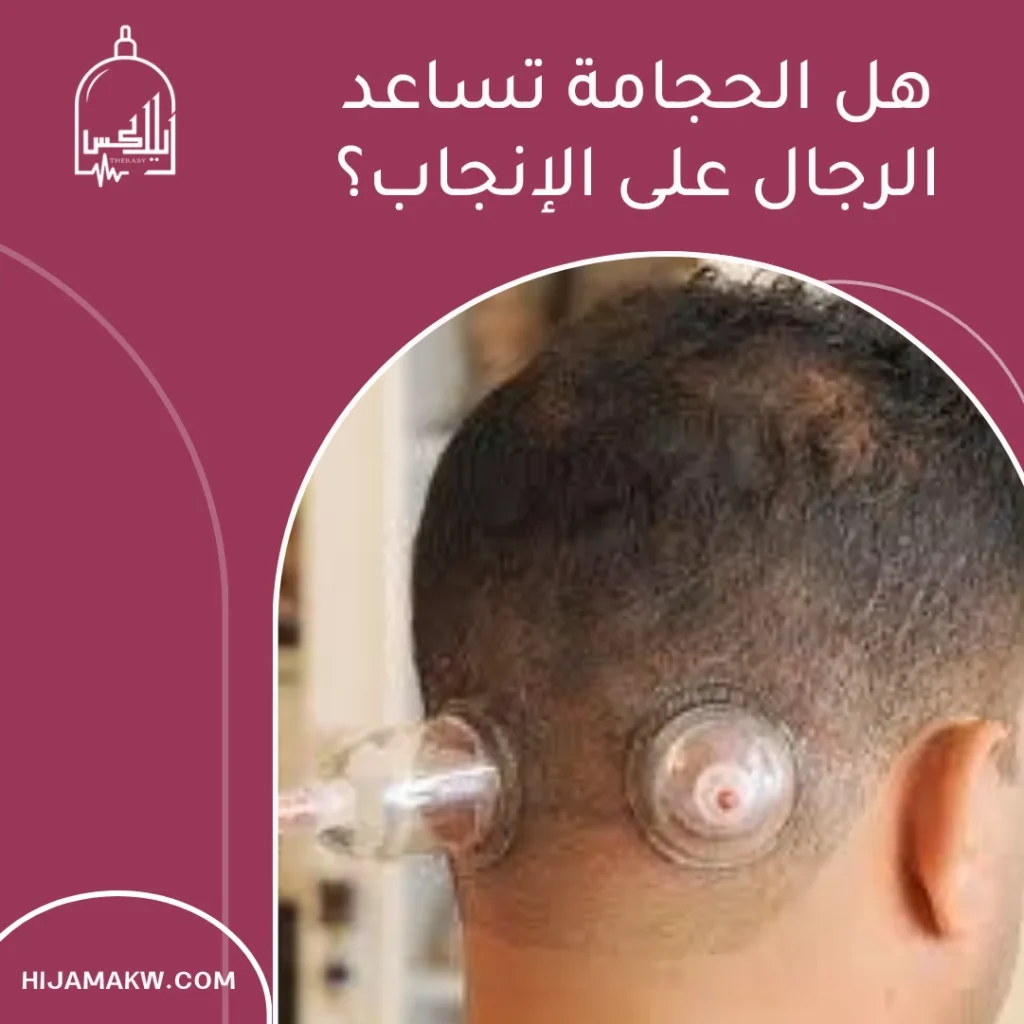 فوائد الحجامة للرجال للانجاب