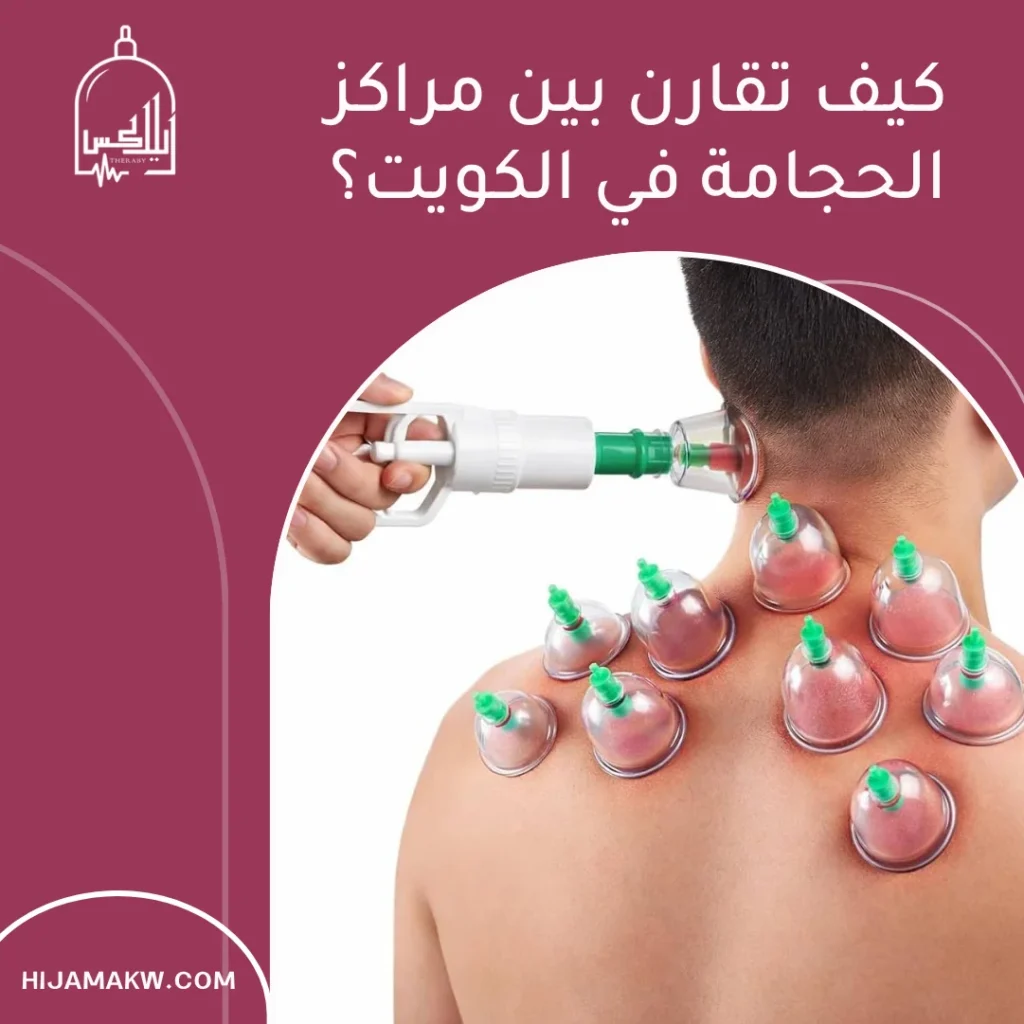 افضل مركز حجامة في الكويت