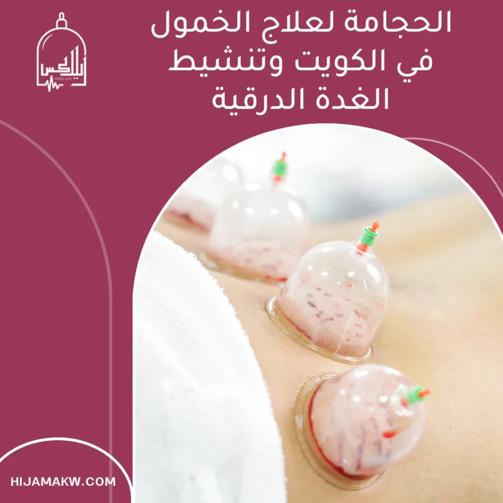 الحجامة لعلاج الخمول في الكويت