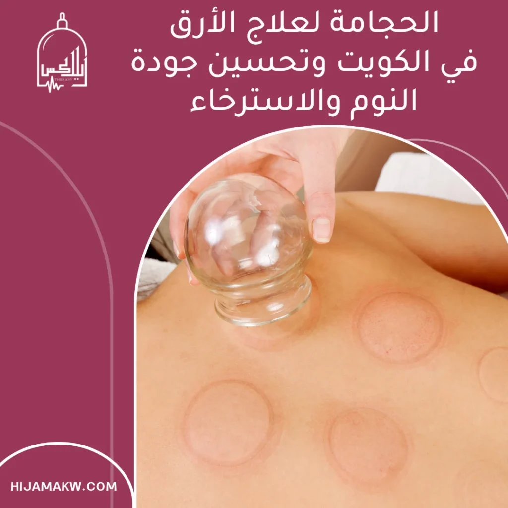 الحجامة لعلاج الأرق في الكويت