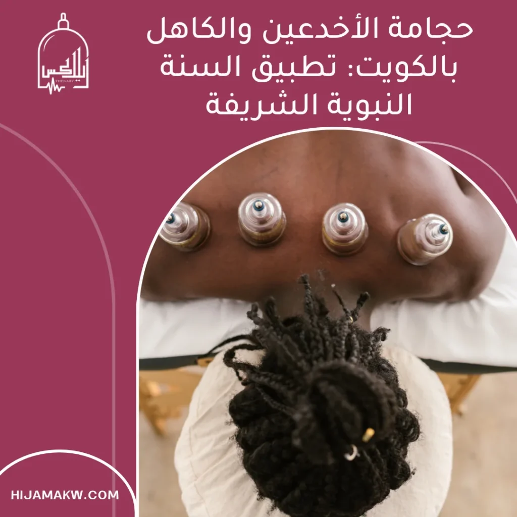 حجامة الأخدعين والكاهل بالكويت