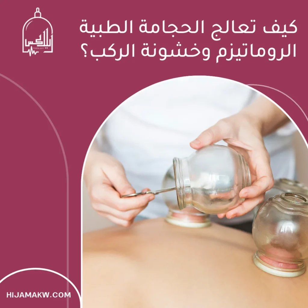 حجامة الروماتيزم في الكويت