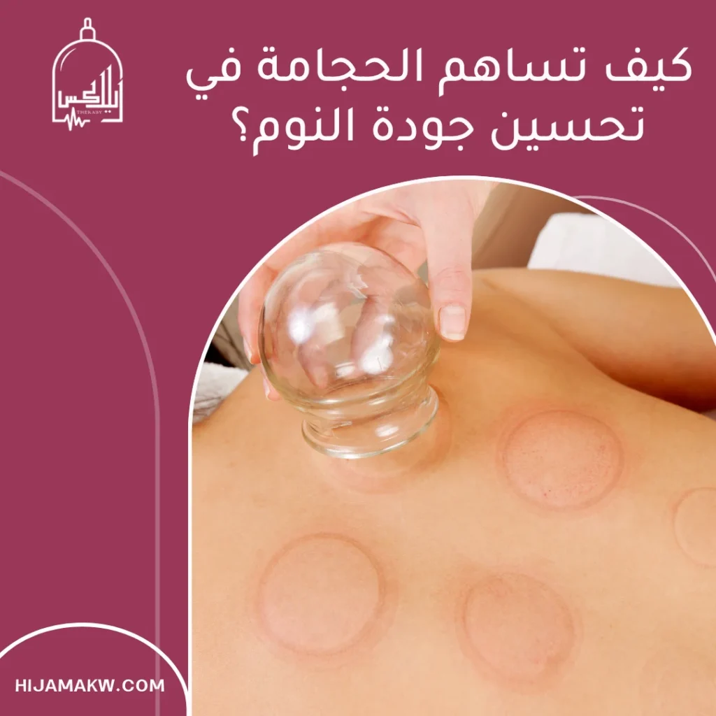 الحجامة لعلاج الأرق في الكويت