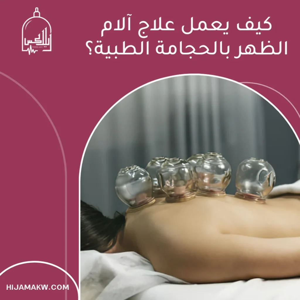 الحجامة الطبية في الكويت