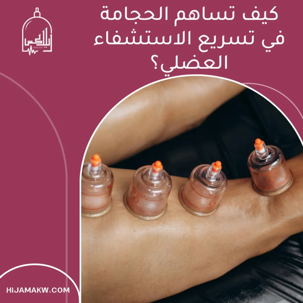 حجامة الرياضيين في الكويت