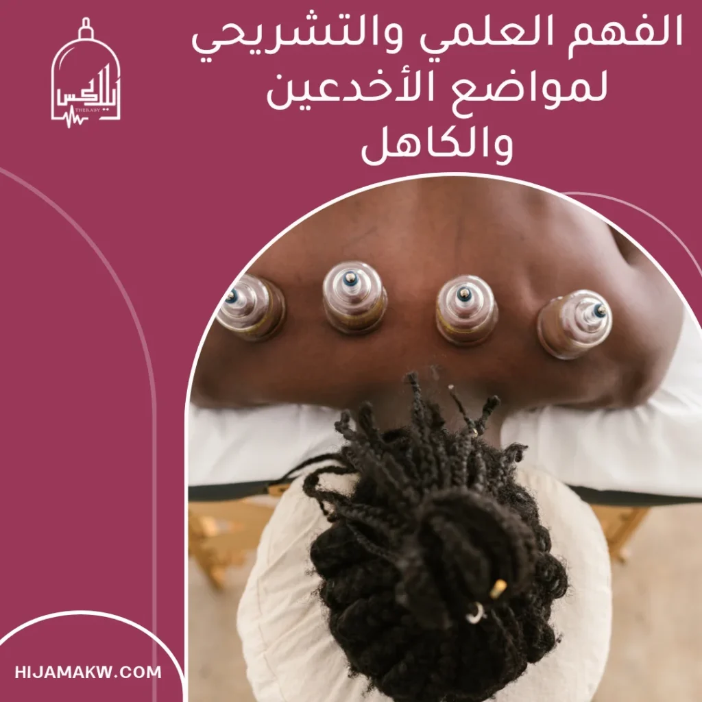 حجامة الأخدعين والكاهل بالكويت