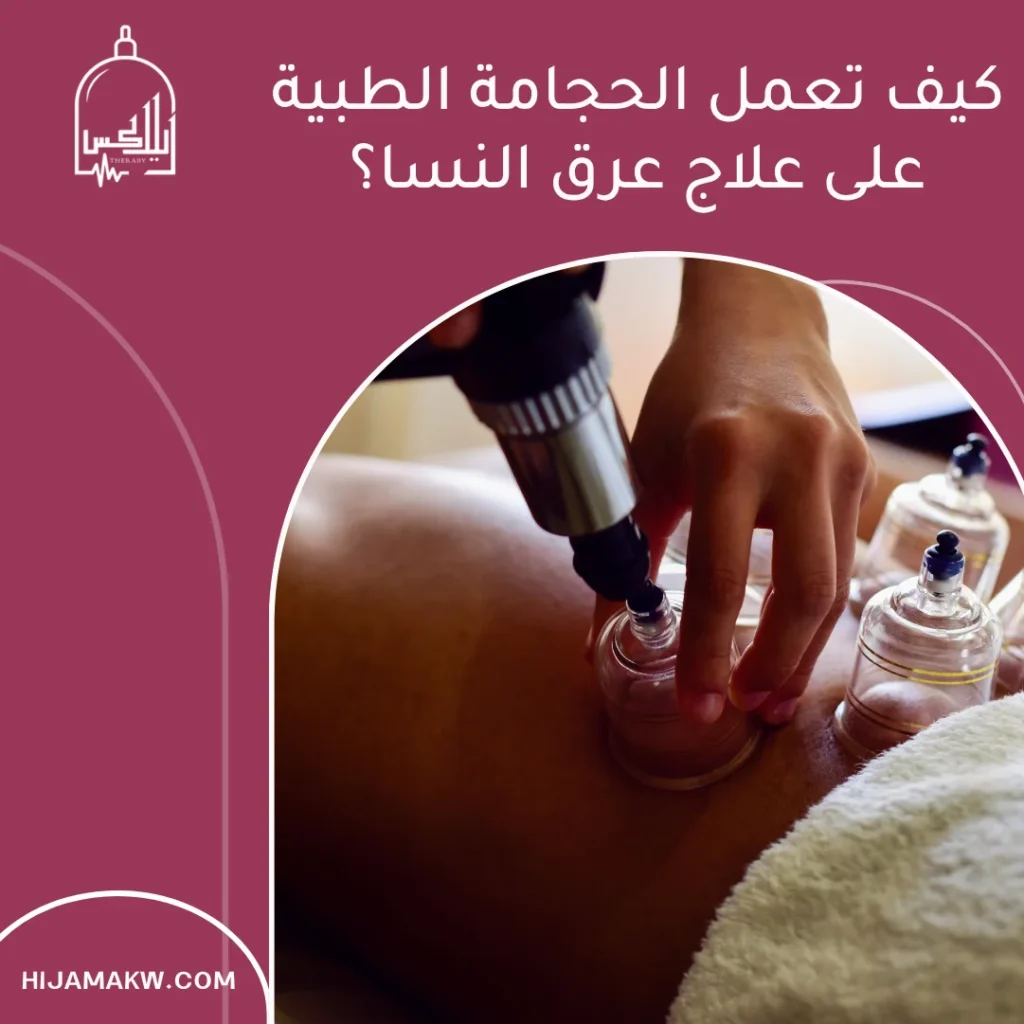 علاج عرق النسا بالحجامة في الكويت