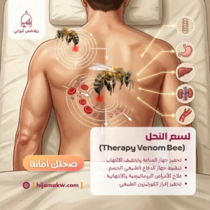 الرئيسية 33 Therapy Venom Bee