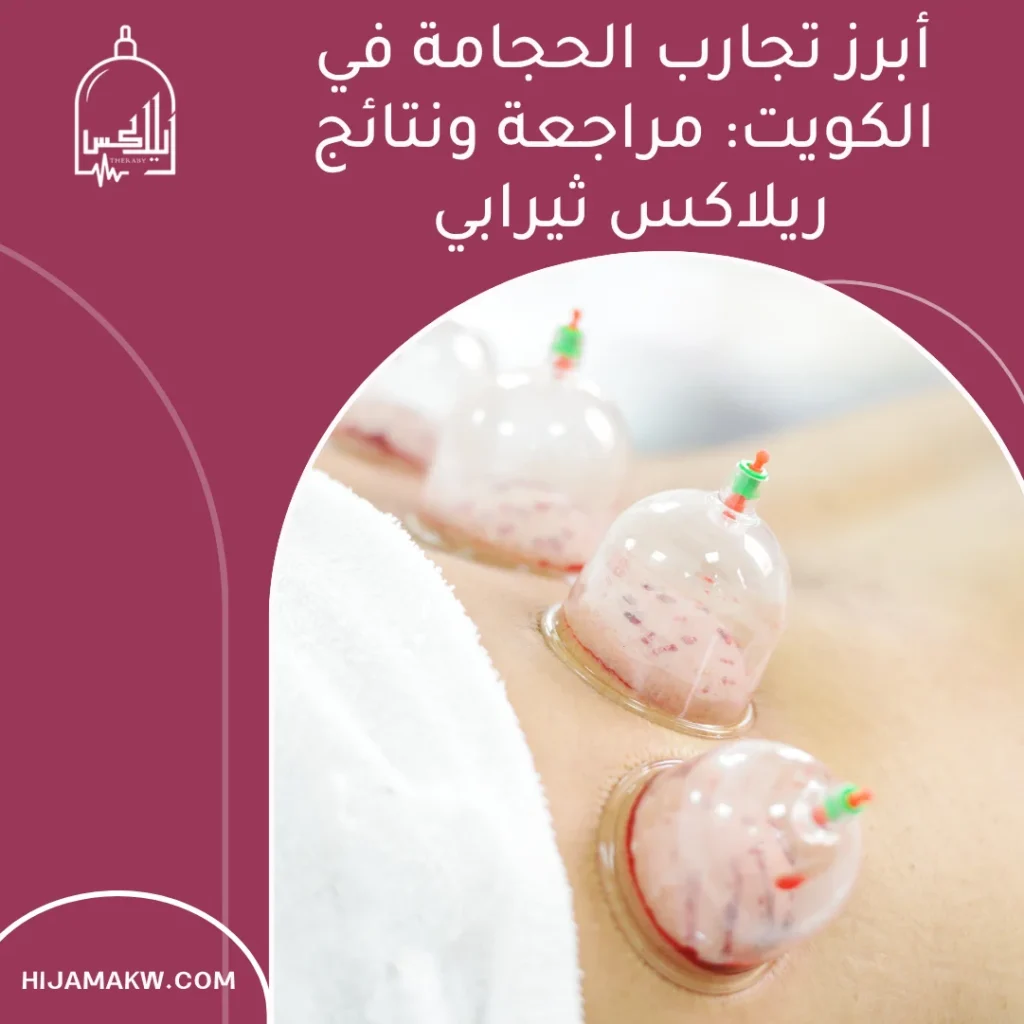 تجارب الحجامة في الكويت
