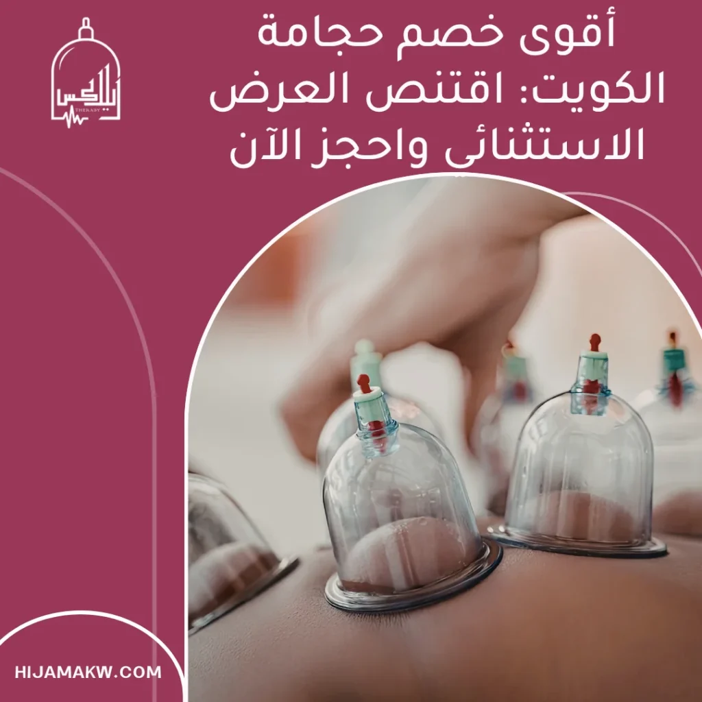 خصم حجامة الكويت